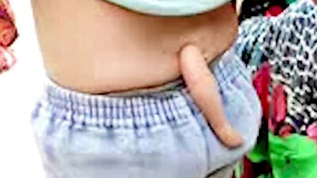 Bé trai được tôn thờ như vị thần vì có đuôi dài như khỉ