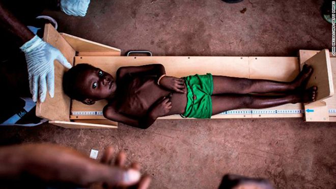 2017 - Năm ác mộng với những đứa trẻ vì nỗi đau bạo lực, chiến tranh