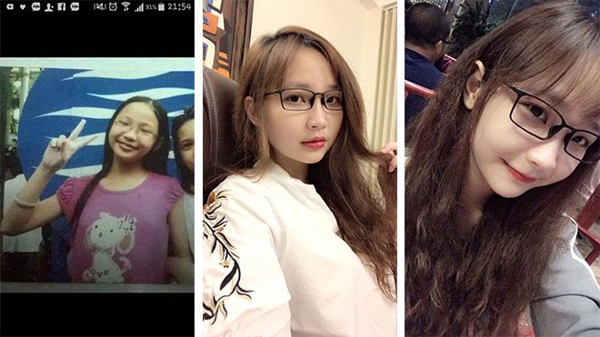 Ca 'dậy thì' hơn cả thành công: Cô gái đen-béo-mụn trở nên trắng trẻo, xinh đẹp đến khó tin