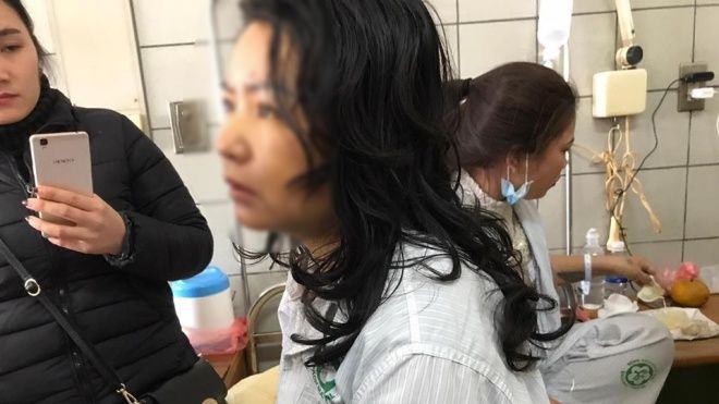 Nữ nhân viên điều dưỡng hôn mê bất tỉnh sau khi uống thực phẩm giảm cân