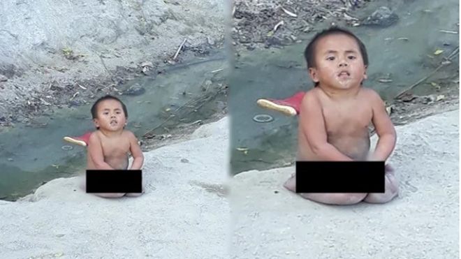 Em bé ở Mường Lát được vợ chồng Sài Gòn nhận nuôi phải nhập viện