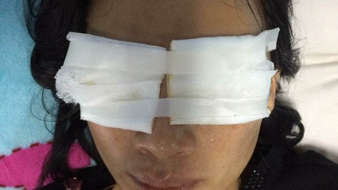 Mẹ chồng tạt axit con dâu được phát hiện đã chết tại nhà