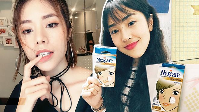 Bí kíp loại sạch mụn đơn giản chỉ trong 3 ngày không phải ai cũng biết