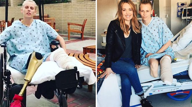 Sử dụng băng vệ sinh sai cách, người phụ nữ suýt nữa mất mạng, phải cắt bỏ cả 2 chân vì đau đớn