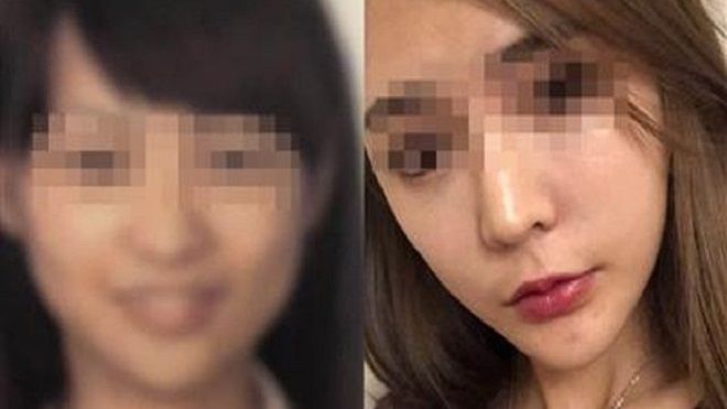 Gọt cằm quá đà, cô gái khóc ròng không thể về quê vì quá khác với ảnh hộ chiếu