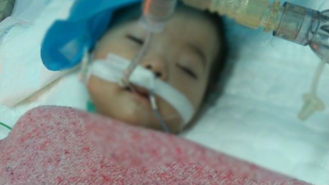 Bé gái 8 tháng tuổi lên cơn co giật, hôn mê sâu sau khi tiêm thuốc tại bệnh viện