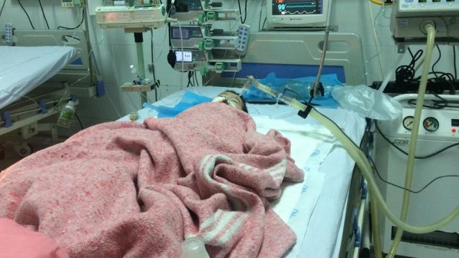 Vụ bé 8 tháng tuổi co giật sau khi tiêm: Đình chỉ 30 ngày nữ điều dưỡng sai đường dùng thuốc