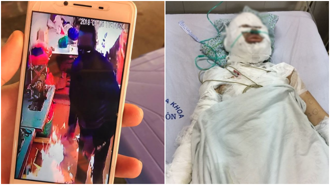 Vụ cô gái bị người ngoại quốc tẩm xăng đốt: ‘Ông ấy có tình cảm nhưng cô H. không thích’