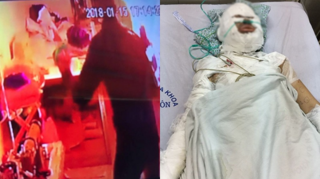 Vụ cô gái bị người đàn ông ngoại quốc tẩm xăng đốt: Nghi phạm có thể trốn sang Philippines