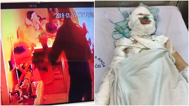 Nghi phạm tẩm xăng thiêu sống cô gái đối diện mức án 20 năm tù?