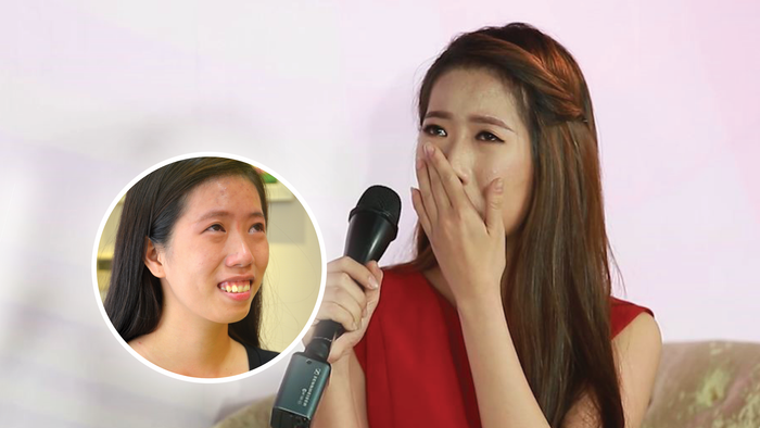 Hành trình thay đổi diện mạo của cô gái từng sống trong mặc cảm với gương mặt bị hàm hô