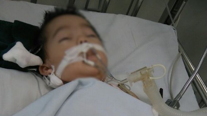 Bé gái 8 tháng tuổi bị nữ điều dưỡng tiêm nhầm kali thay vì đường uống có dấu hiệu chết não