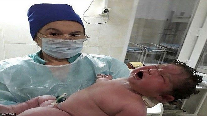 Sốc: Chẳng cần thuốc giảm đau, bà mẹ vẫn sinh thành công em bé nặng 6kg