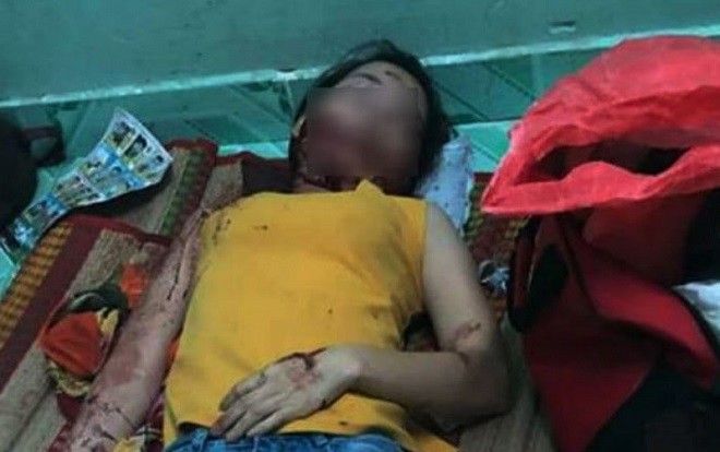Nghi án người phụ nữ bị chồng chém gục vì ghen tuông vào sáng 26 Tết
