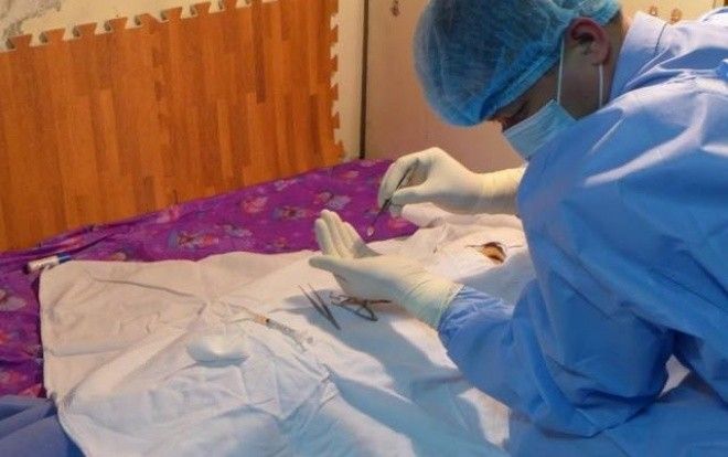 Ghép thành công giác mạc cho hai bệnh nhân được bé gái 7 tuổi hiến tặng