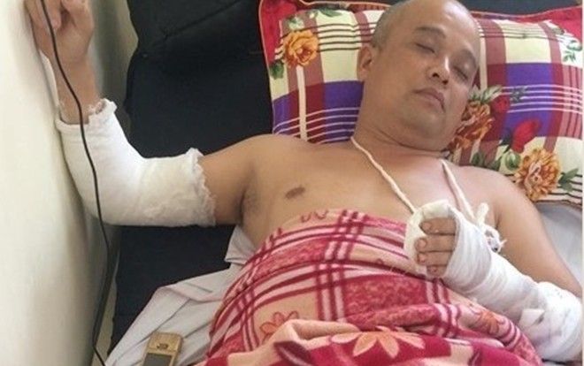 Điều tra vụ người đàn ông bất ngờ bị chém gục khi đi ăn cháo đêm