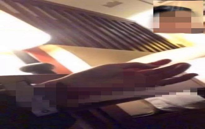 Thất tình, cô gái gọi video call cho bạn trai cũ để chứng kiến cảnh cắt tay tự tử