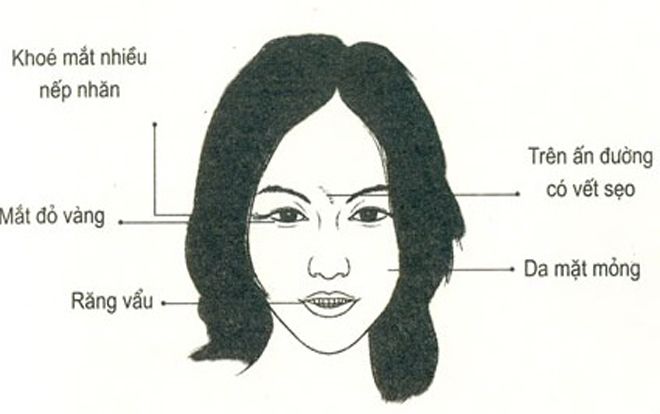 Nhân tướng học: Những đặc điểm xấu trên gương mặt phụ nữ