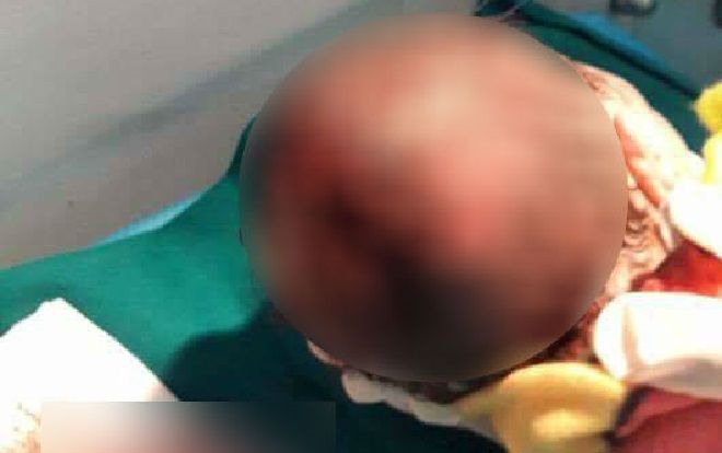 Đỡ đẻ cho con dâu, bà nội dùng dao rạch rách đầu cháu