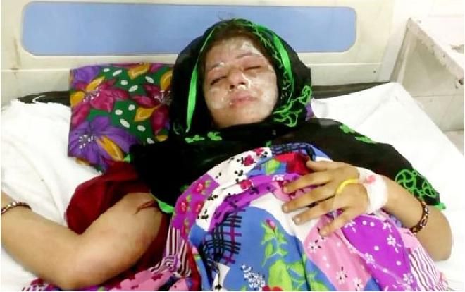 Chồng nhẫn tâm tạt axit vợ vì lúc đang ngủ vì sinh hai con gái