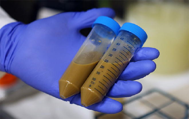 Rùng mình với phương pháp chữa bệnh bằng phân đến nay vẫn chưa có lời giải