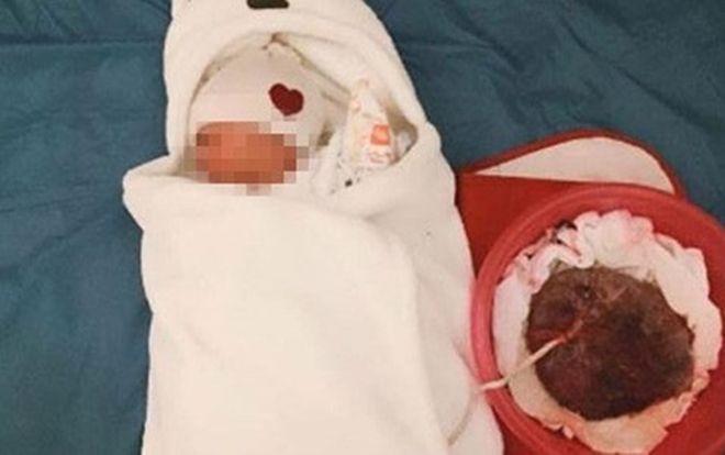 Làm rõ thông tin mẹ con sản phụ tử vong vì theo trào lưu 'sinh thuận tự nhiên'