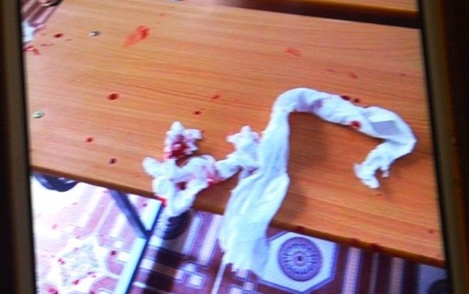 Thầy giáo bộ môn bị phụ huynh học sinh đánh gãy sống mũi