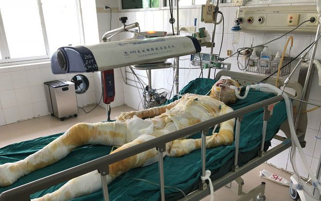 Cô gái 9X bị tạt xăng thiêu sống khi đang ngủ