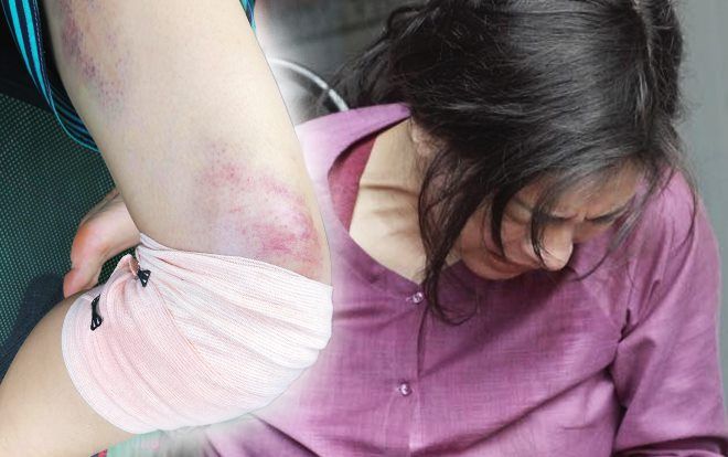 Xót xa trước hình ảnh chấn thương nghiêm trọng của Ngô Thanh Vân trên phim trường