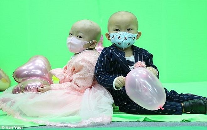 Sự thật phía sau bộ ảnh cưới đặc biệt của cô dâu - chú rể 2 tuổi