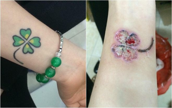 Xóa hình xăm cỏ bốn lá để quên mối tình 4 năm bỗng 'cắm sừng' sau 3 năm chờ đợi, cô gái nhận kết cực đắng