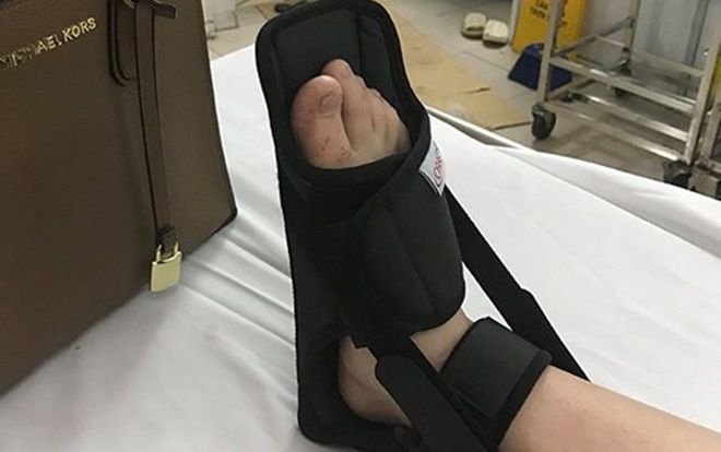 Nữ sinh bị gãy chân do bị lừa ngày Cá tháng tư