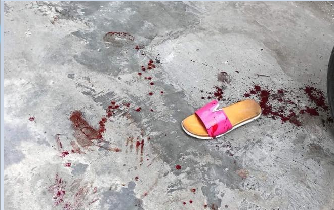 Mang súng giải quyết mâu thuẫn giữa 2 đứa trẻ, một phụ nữ bị thương nặng