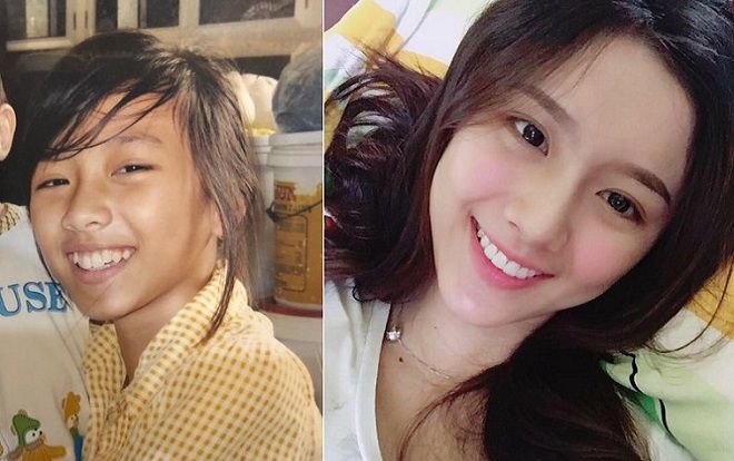 Kiên trì niềng răng suốt 4 năm, 9X Kiên Giang có nụ cười rạng rỡ không thua gì hot girl