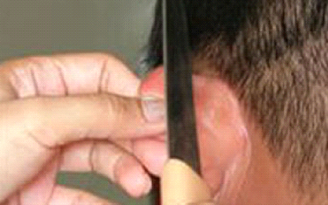 Cô gái bị chích điện, cắt vành tai vì trả nợ chậm