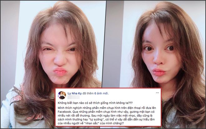 Không phải phẫu thuật thẩm mỹ, đây mới là nguyên nhân khiến gương mặt Lý Nhã Kỳ 'biến dạng'