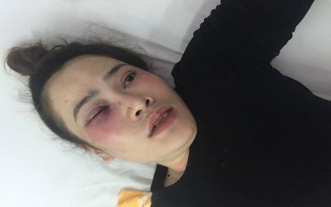 Cha của nam thanh niên đánh cô gái trong quán bánh xèo lên tiếng xin lỗi thay con