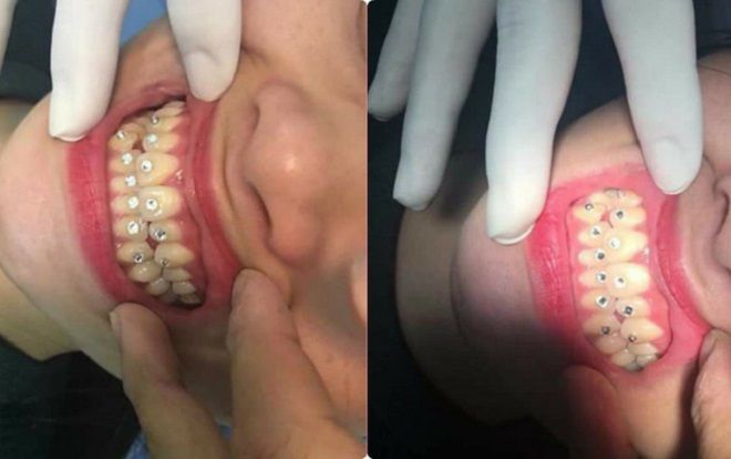 'Nụ cười tỏa nắng' của cô nàng khiến ai nấy đều 'gục ngã'