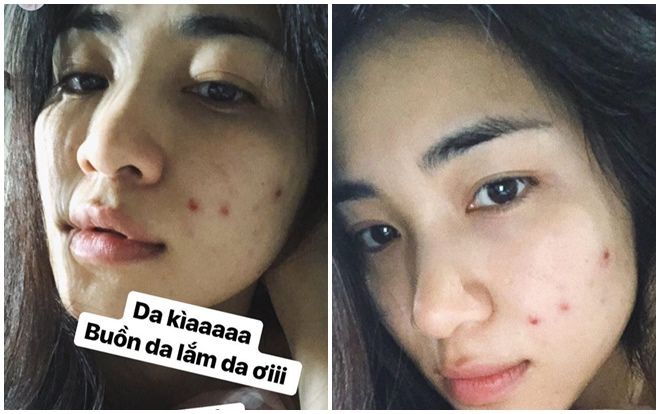 Hòa Minzy xuống phong độ với làn da đầy mụn, gương mặt phờ phạc khiến fans lo lắng