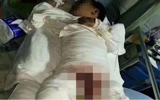 Cô giáo mầm non dội nước sôi vào người trẻ gây phẫn nộ