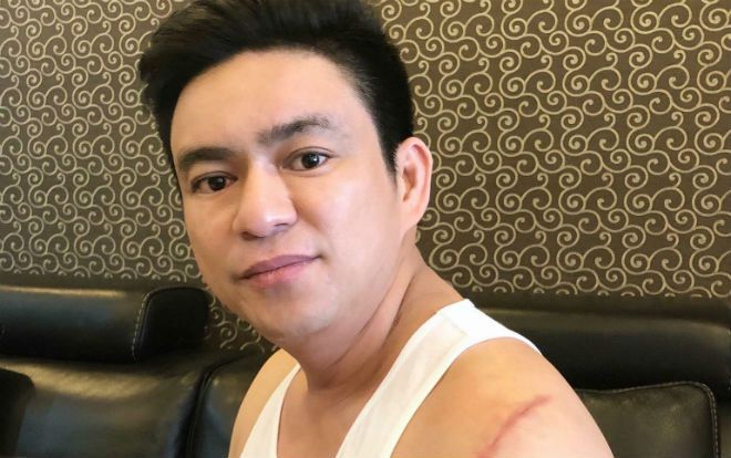 Bác sĩ Chiêm Quốc Thái bị nhóm người mang hung khí chém trọng thương ở Phố đi bộ