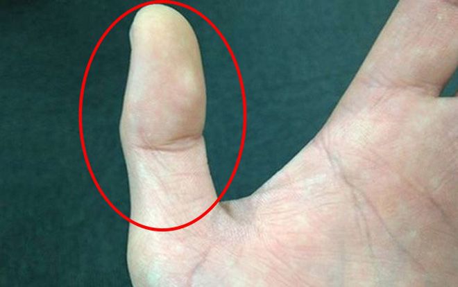 Nhìn độ dài hai đốt ngón tay cái biết ngay tình duyên lận đận hay suôn sẻ