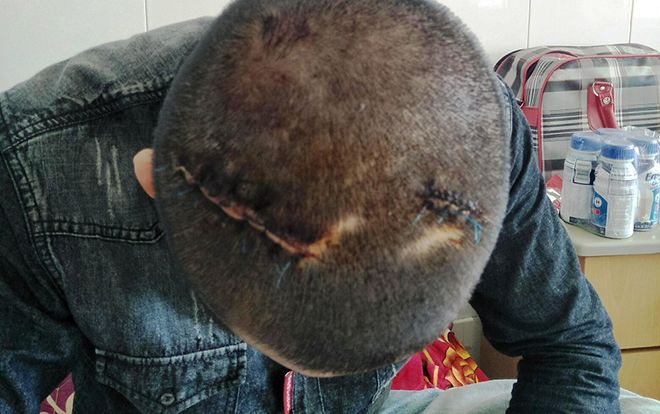 Điều tra vụ chém nhau tại nhà giám đốc công ty xe buýt