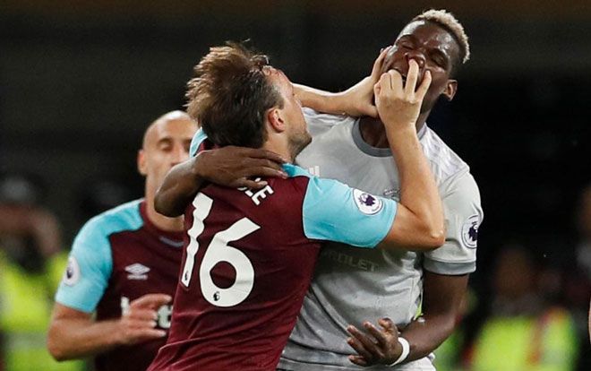 Pogba bị đội trưởng West Ham móc mũi và bóp cổ