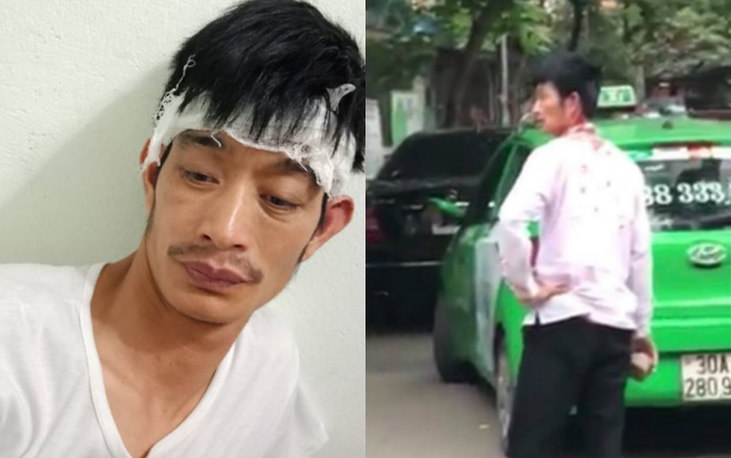Tài xế taxi bị người đàn ông đi Mercedes cầm gạch đánh chảy máu đầu: ‘Tôi không hoà giải’