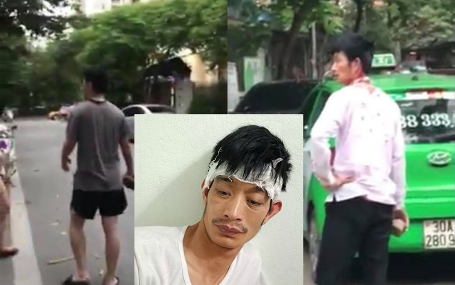Tài xế taxi bị người đàn ông đi xe Mercedes đánh chảy máu phải chuyển lên bệnh viện Việt Đức