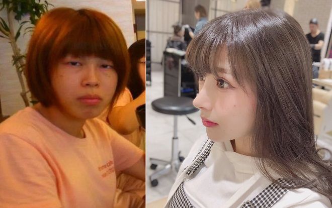 Chi hơn 1 tỷ để PTTM, hot girl được nhận xét 'trông như vừa được đầu thai'