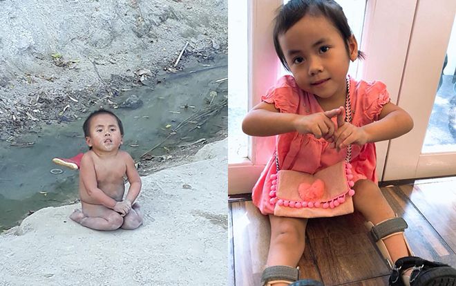 Vỡ òa trước hành trình thay da đổi thịt của em bé Mường Lát sau 5 tháng về ‘nhà’