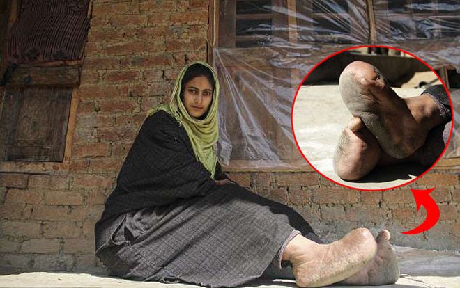 Đi giày dép là chuyện quá bình thường nhưng với cô gái này đó lại là điều xa xỉ