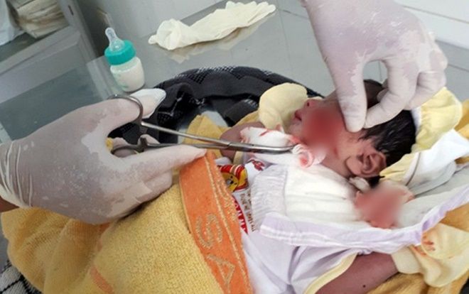 Cứu kịp thời bé sơ sinh bị chôn sống